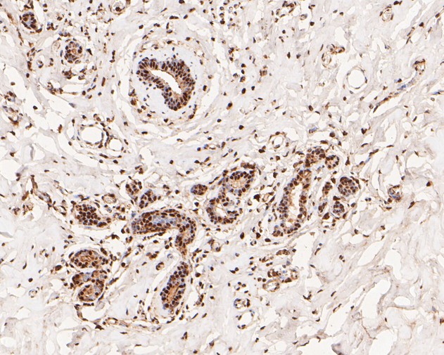 Immunohistochemical analysis of paraffin-embedded human breast tissue using anti-NFYA antibody. The section was pre-treated using heat mediated antigen retrieval with sodium citrate buffer (pH 6.0) for 20 minutes. The tissues were blocked in 5% BSA for 30 minutes at room temperature, washed with ddH2O and PBS, and then probed with the primary antibody (ET7110-85, 1/100)  for 30 minutes at room temperature. The detection was performed using an HRP conjugated compact polymer system. DAB was used as the chromogen. Tissues were counterstained with hematoxylin and mounted with DPX.