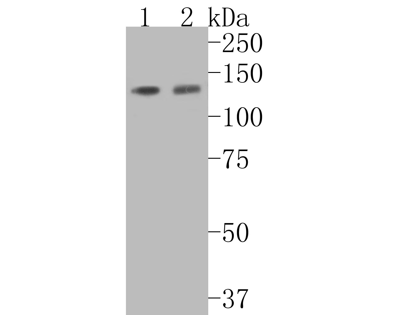 Western blot analysis of Tat-SF1 on different lysates with Rabbit anti-Tat-SF1 antibody (ET7110-87) at 1/500 dilution.<br />
<br />
Lane 1: CRC cell lysate<br />
Lane 2: MCF-7 cell lysate<br />
<br />
Lysates/proteins at 10 µg/Lane.<br />
<br />
Predicted band size: 86 kDa<br />
Observed band size: 120 kDa<br />
<br />
Exposure time: 2 minutes;<br />
<br />
8% SDS-PAGE gel.<br />
<br />
Proteins were transferred to a PVDF membrane and blocked with 5% NFDM/TBST for 1 hour at room temperature. The primary antibody (ET7110-87) at 1/500 dilution was used in 5% NFDM/TBST at room temperature for 2 hours. Goat Anti-Rabbit IgG - HRP Secondary Antibody (HA1001) at 1:5,000 dilution was used for 1 hour at room temperature.