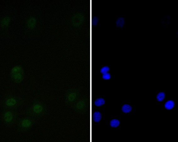 Immunocytochemistry analysis of MCF-7 cells labeling Tat-SF1 with Rabbit anti-Tat-SF1 antibody (ET7110-87) at 1/100 dilution.<br />
<br />
Cells were fixed in 4% paraformaldehyde for 10 minutes at 37 ℃, permeabilized with 0.05% Triton X-100 in PBS for 20 minutes, and then blocked with 2% negative goat serum for 30 minutes at room temperature. Cells were then incubated with Rabbit anti-Tat-SF1 antibody (ET7110-87) at 1/100 dilution in 2% negative goat serum overnight at 4 ℃.Alexa Fluor®488 Goat anti-Rabbit IgG  was used as the secondary antibody at 1/1,000 dilution.Nuclear DNA was labelled in blue with DAPI.
