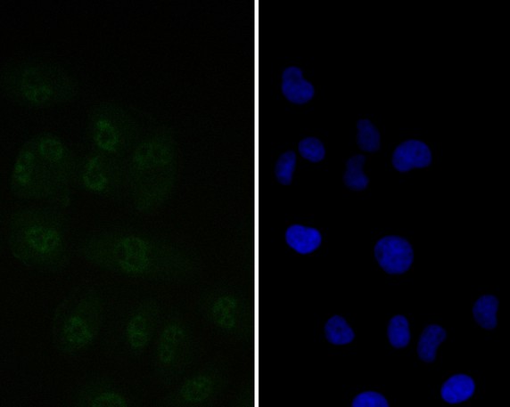 Immunocytochemistry analysis of RWPE-1 cells labeling Tat-SF1 with Rabbit anti-Tat-SF1 antibody (ET7110-87) at 1/50 dilution.<br />
<br />
Cells were fixed in 4% paraformaldehyde for 10 minutes at 37 ℃, permeabilized with 0.05% Triton X-100 in PBS for 20 minutes, and then blocked with 2% negative goat serum for 30 minutes at room temperature. Cells were then incubated with Rabbit anti-Tat-SF1 antibody (ET7110-87) at 1/50 dilution in 2% negative goat serum overnight at 4 ℃.Alexa Fluor®488 Goat anti-Rabbit IgG  was used as the secondary antibody at 1/1,000 dilution. Nuclear DNA was labelled in blue with DAPI.