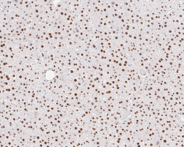 Immunohistochemical analysis of paraffin-embedded mouse liver tissue with Rabbit anti-Tat-SF1 antibody (ET7110-87) at 1/100 dilution.<br />
<br />
The section was pre-treated using heat mediated antigen retrieval with Tris-EDTA buffer (pH 6.0) for 20 minutes. The tissues were blocked in 1% BSA for 20 minutes at room temperature, washed with ddH2O and PBS, and then probed with the primary antibody (ET7110-87) at 1/100 dilution for 0.5 hour at room temperature. The detection was performed using an HRP conjugated compact polymer system. DAB was used as the chromogen. Tissues were counterstained with hematoxylin and mounted with DPX.