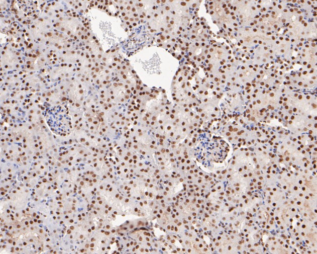 Immunohistochemical analysis of paraffin-embedded mouse kidney tissue with Rabbit anti-Tat-SF1 antibody (ET7110-87) at 1/100 dilution.<br />
<br />
The section was pre-treated using heat mediated antigen retrieval with Tris-EDTA buffer (pH 6.0) for 20 minutes. The tissues were blocked in 1% BSA for 20 minutes at room temperature, washed with ddH2O and PBS, and then probed with the primary antibody (ET7110-87) at 1/100 dilution for 0.5 hour at room temperature. The detection was performed using an HRP conjugated compact polymer system. DAB was used as the chromogen. Tissues were counterstained with hematoxylin and mounted with DPX.