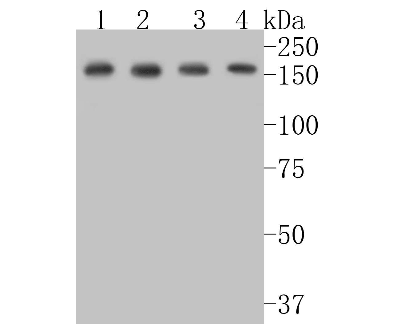"Western blot analysis of BAT3 on different lysates. Proteins were transferred to a PVDF membrane and blocked with 5% BSA in PBS for 1 hour at room temperature. The primary antibody (ET7110-88, 1/500) was used in 5% BSA at room temperature for 2 hours. Goat Anti-Rabbit IgG - HRP Secondary Antibody (HA1001) at 1:5,000 dilution was used for 1 hour at room temperature.<br />
Positive control: <br />
Lane 1: Rat testis tissue lysate<br />
Lane 2: 293 cell lysate<br />
Lane 3: HepG2 cell lysate<br />
Lane 4: Rat brain tissue lysate