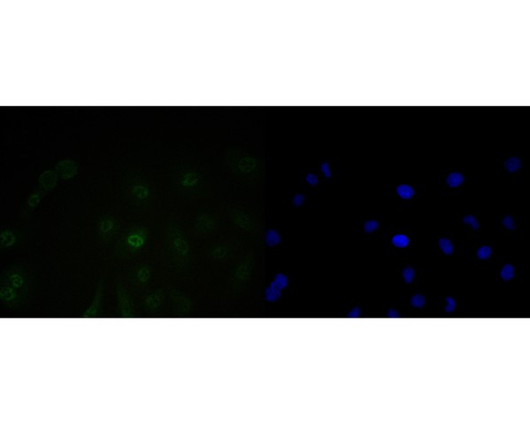 ICC staining of BAT3 in A549 cells (green). Formalin fixed cells were permeabilized with 0.1% Triton X-100 in TBS for 10 minutes at room temperature and blocked with 1% Blocker BSA for 15 minutes at room temperature. Cells were probed with the primary antibody (ET7110-88, 1/50) for 1 hour at room temperature, washed with PBS. Alexa Fluor®488 Goat anti-Rabbit IgG was used as the secondary antibody at 1/1,000 dilution. The nuclear counter stain is DAPI (blue).