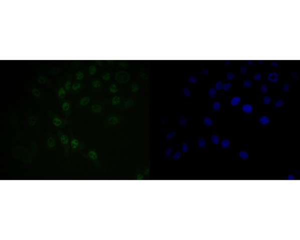 ICC staining of BAT3 in HepG2 cells (green). Formalin fixed cells were permeabilized with 0.1% Triton X-100 in TBS for 10 minutes at room temperature and blocked with 1% Blocker BSA for 15 minutes at room temperature. Cells were probed with the primary antibody (ET7110-88, 1/50) for 1 hour at room temperature, washed with PBS. Alexa Fluor®488 Goat anti-Rabbit IgG was used as the secondary antibody at 1/1,000 dilution. The nuclear counter stain is DAPI (blue).