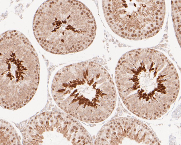 Immunohistochemical analysis of paraffin-embedded rat testis tissue using anti-BAT3 antibody. The section was pre-treated using heat mediated antigen retrieval with sodium citrate buffer (pH 6.0) for 20 minutes. The tissues were blocked in 5% BSA for 30 minutes at room temperature, washed with ddH2O and PBS, and then probed with the primary antibody (ET7110-88, 1/200)  for 30 minutes at room temperature. The detection was performed using an HRP conjugated compact polymer system. DAB was used as the chromogen. Tissues were counterstained with hematoxylin and mounted with DPX.