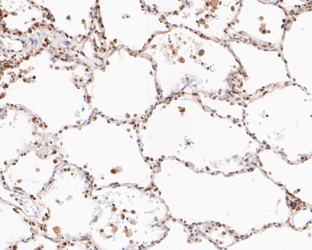 Immunohistochemical analysis of paraffin-embedded human lung tissue using anti-BAT3 antibody. The section was pre-treated using heat mediated antigen retrieval with sodium citrate buffer (pH 6.0) for 20 minutes. The tissues were blocked in 5% BSA for 30 minutes at room temperature, washed with ddH2O and PBS, and then probed with the primary antibody (ET7110-88, 1/200)  for 30 minutes at room temperature. The detection was performed using an HRP conjugated compact polymer system. DAB was used as the chromogen. Tissues were counterstained with hematoxylin and mounted with DPX.