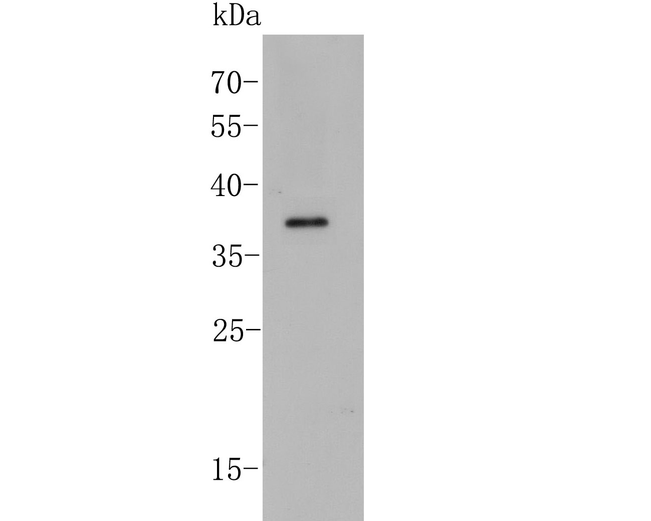 Western blot analysis of PEX19 on Raji cell lysates with Rabbit anti-PEX19 antibody (ET7110-89) at 1/500 dilution.<br />
<br />
Lysates/proteins at 10 µg/Lane.<br />
<br />
Predicted band size: 33 kDa<br />
Observed band size: 37 kDa<br />
<br />
Exposure time: 2 minutes;<br />
<br />
12% SDS-PAGE gel.<br />
<br />
Proteins were transferred to a PVDF membrane and blocked with 5% NFDM/TBST for 1 hour at room temperature. The primary antibody (ET7110-89) at 1/500 dilution was used in 5% NFDM/TBST at room temperature for 2 hours. Goat Anti-Rabbit IgG - HRP Secondary Antibody (HA1001) at 1:5,000 dilution was used for 1 hour at room temperature.