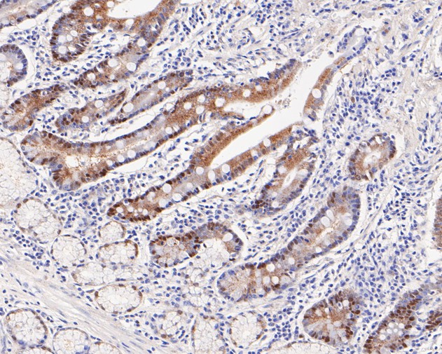Immunohistochemical analysis of paraffin-embedded  human small intestine tissue with Rabbit anti-PEX19 antibody (ET7110-89) at 1/100 dilution.<br />
<br />
The section was pre-treated using heat mediated antigen retrieval with Tris-EDTA buffer (pH 8.0-8.4)) for 20 minutes. The tissues were blocked in 1% BSA for 20 minutes at room temperature, washed with ddH2O and PBS, and then probed with the primary antibody (ET7110-89) at 1/100 dilution for 0.5 hour at room temperature. The detection was performed using an HRP conjugated compact polymer system. DAB was used as the chromogen. Tissues were counterstained with hematoxylin and mounted with DPX.