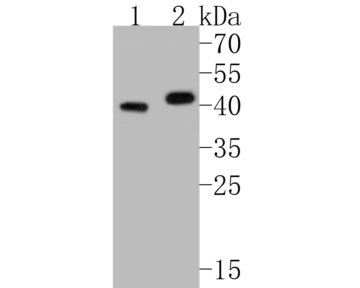 Western blot analysis of Kallikrein 5 on different lysates with Rabbit anti-Kallikrein 5 antibody (ET7110-90) at 1/500 dilution.<br />
<br />
Lane 1: MCF-7 cell lysate<br />
Lane 2: SK-Br-3 cell lysate<br />
<br />
Lysates/proteins at 10 µg/Lane.<br />
<br />
Predicted band size: 32 kDa<br />
Observed band size: 40 kDa<br />
<br />
Exposure time: 2 minutes;<br />
<br />
6% SDS-PAGE gel.<br />
<br />
Proteins were transferred to a PVDF membrane and blocked with 5% NFDM/TBST for 1 hour at room temperature. The primary antibody (ET7110-90) at 1/500 dilution was used in 5% NFDM/TBST at room temperature for 2 hours. Goat Anti-Rabbit IgG - HRP Secondary Antibody (HA1001) at 1:5,000 dilution was used for 1 hour at room temperature.