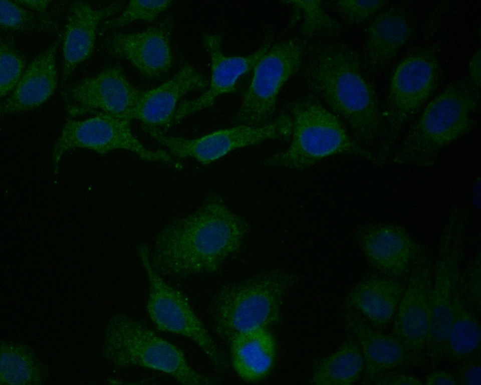 ICC staining of P4HB in HepG2 cells (green). Formalin fixed cells were permeabilized with 0.1% Triton X-100 in TBS for 10 minutes at room temperature and blocked with 1% Blocker BSA for 15 minutes at room temperature. Cells were probed with the primary antibody (ET7110-92, 1/100) for 1 hour at room temperature, washed with PBS. Alexa Fluor®488 Goat anti-Rabbit IgG was used as the secondary antibody at 1/1,000 dilution. The nuclear counter stain is DAPI (blue).
