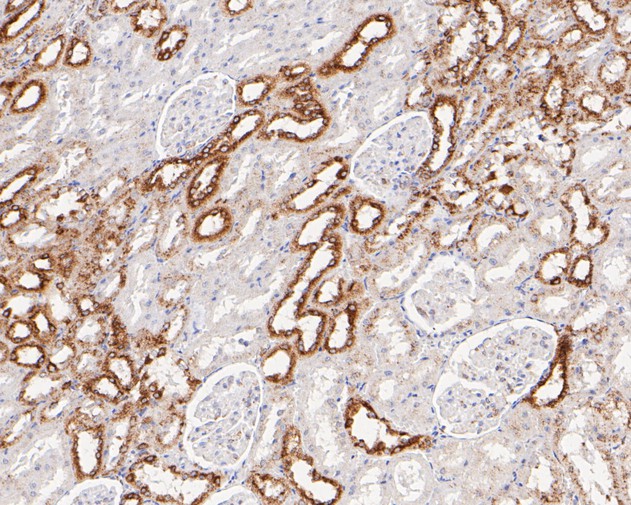 Immunohistochemical analysis of paraffin-embedded rat kidney tissue using anti-P4HB antibody. The section was pre-treated using heat mediated antigen retrieval with Tris-EDTA buffer (pH 8.0-8.4) for 20 minutes.The tissues were blocked in 5% BSA for 30 minutes at room temperature, washed with ddH2O and PBS, and then probed with the primary antibody (ET7110-92, 1/50) for 30 minutes at room temperature. The detection was performed using an HRP conjugated compact polymer system. DAB was used as the chromogen. Tissues were counterstained with hematoxylin and mounted with DPX.
