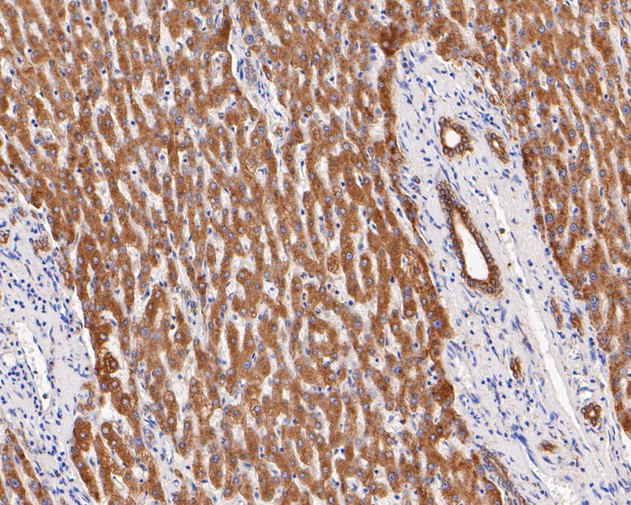 Immunohistochemical analysis of paraffin-embedded human liver tissue using anti-P4HB antibody. The section was pre-treated using heat mediated antigen retrieval with Tris-EDTA buffer (pH 8.0-8.4) for 20 minutes.The tissues were blocked in 5% BSA for 30 minutes at room temperature, washed with ddH2O and PBS, and then probed with the primary antibody (ET7110-92, 1/200) for 30 minutes at room temperature. The detection was performed using an HRP conjugated compact polymer system. DAB was used as the chromogen. Tissues were counterstained with hematoxylin and mounted with DPX.