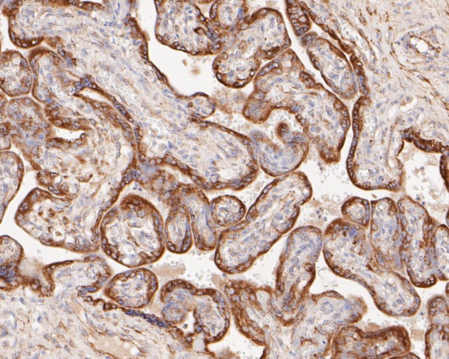 Immunohistochemical analysis of paraffin-embedded human placenta tissue using anti-P4HB antibody. The section was pre-treated using heat mediated antigen retrieval with Tris-EDTA buffer (pH 8.0-8.4) for 20 minutes.The tissues were blocked in 5% BSA for 30 minutes at room temperature, washed with ddH2O and PBS, and then probed with the primary antibody (ET7110-92, 1/50) for 30 minutes at room temperature. The detection was performed using an HRP conjugated compact polymer system. DAB was used as the chromogen. Tissues were counterstained with hematoxylin and mounted with DPX.