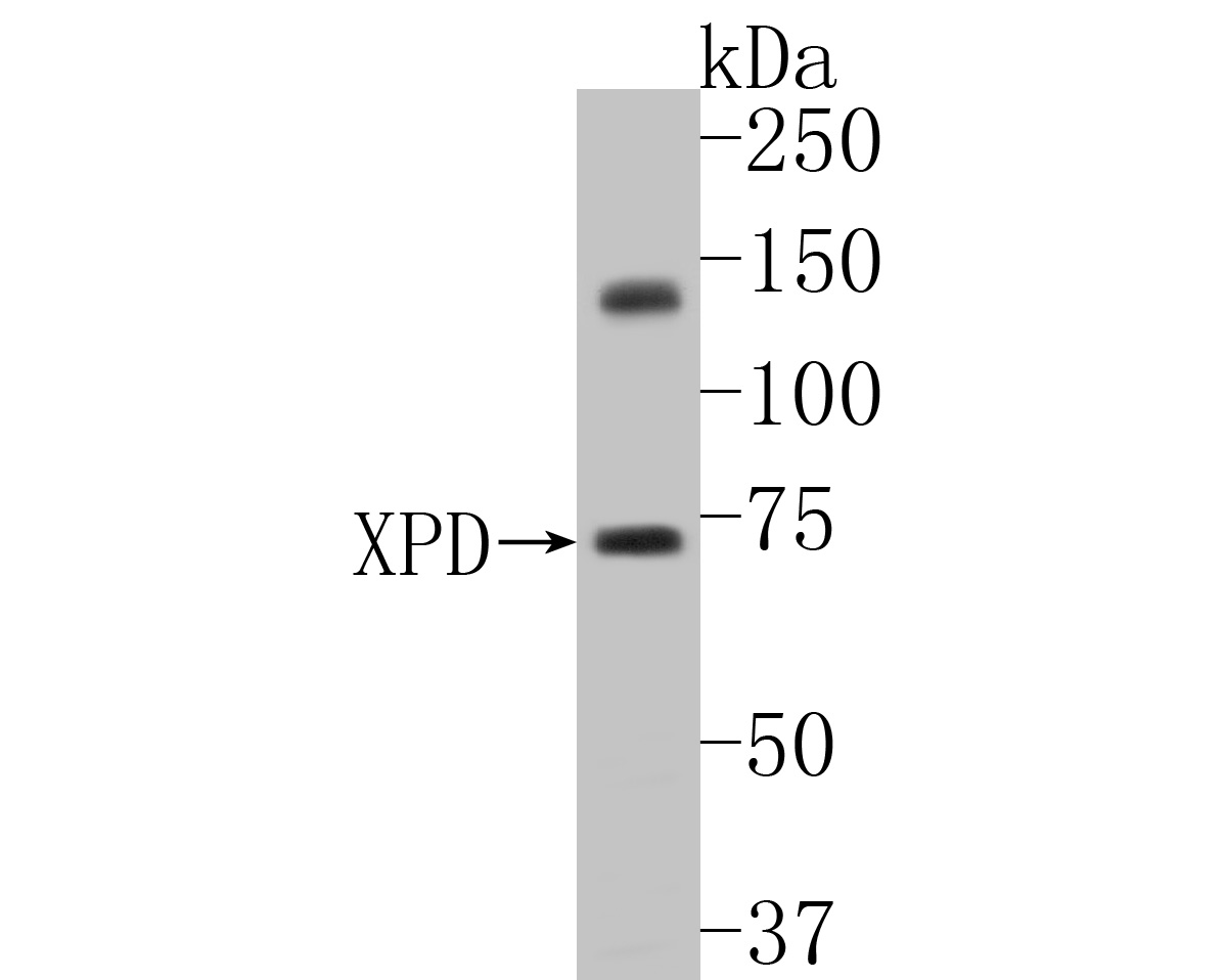 Western blot analysis of XPD on K562 cell lysates. Proteins were transferred to a PVDF membrane and blocked with 5% BSA in PBS for 1 hour at room temperature. The primary antibody (ET7110-93, 1/1,000) was used in 5% BSA at room temperature for 2 hours. Goat Anti-Rabbit IgG - HRP Secondary Antibody (HA1001) at 1:5,000 dilution was used for 1 hour at room temperature.
