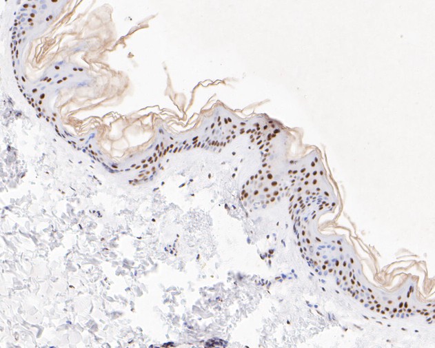 Immunohistochemical analysis of paraffin-embedded human skin tissue using anti-XPD antibody. The section was pre-treated using heat mediated antigen retrieval with sodium citrate buffer (pH 6.0) for 20 minutes. The tissues were blocked in 5% BSA for 30 minutes at room temperature, washed with ddH2O and PBS, and then probed with the primary antibody (ET7110-93, 1/200)  for 30 minutes at room temperature. The detection was performed using an HRP conjugated compact polymer system. DAB was used as the chromogen. Tissues were counterstained with hematoxylin and mounted with DPX.