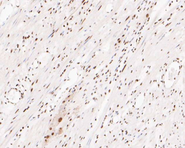 Immunohistochemical analysis of paraffin-embedded human smooth muscle tissue using anti-XPD antibody. The section was pre-treated using heat mediated antigen retrieval with sodium citrate buffer (pH 6.0) for 20 minutes. The tissues were blocked in 5% BSA for 30 minutes at room temperature, washed with ddH2O and PBS, and then probed with the primary antibody (ET7110-93, 1/200) for 30 minutes at room temperature. The detection was performed using an HRP conjugated compact polymer system. DAB was used as the chromogen. Tissues were counterstained with hematoxylin and mounted with DPX.