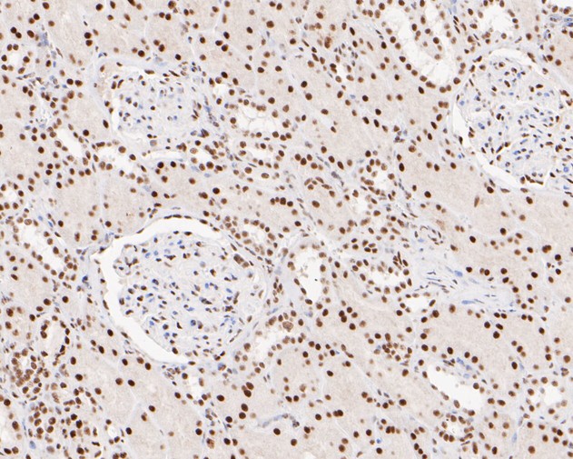 Immunohistochemical analysis of paraffin-embedded human kidney tissue using anti-XPD antibody. The section was pre-treated using heat mediated antigen retrieval with sodium citrate buffer (pH 6.0) for 20 minutes. The tissues were blocked in 5% BSA for 30 minutes at room temperature, washed with ddH2O and PBS, and then probed with the primary antibody (ET7110-93, 1/200)  for 30 minutes at room temperature. The detection was performed using an HRP conjugated compact polymer system. DAB was used as the chromogen. Tissues were counterstained with hematoxylin and mounted with DPX.