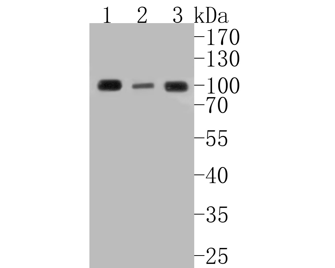 Western blot analysis of RanBP9 on different lysates with Rabbit anti-RanBP9 antibody (ET7110-95) at 1/500 dilution.<br />
<br />
Lane 1: Mouse hippocampus tissue lysate<br />
Lane 2: Rat kidney tissue lysate<br />
Lane 3: SK-Br-3 cell lysate(10 µg/Lane)<br />
<br />
Lysates/proteins at 20 µg/Lane.<br />
<br />
Predicted band size: 116 kDa<br />
Observed band size: 100 kDa<br />
<br />
Exposure time: 2 minutes;<br />
<br />
10% SDS-PAGE gel.<br />
<br />
Proteins were transferred to a PVDF membrane and blocked with 5% NFDM/TBST for 1 hour at room temperature. The primary antibody (ET7110-95) at 1/500 dilution was used in 5% NFDM/TBST at room temperature for 2 hours. Goat Anti-Rabbit IgG - HRP Secondary Antibody (HA1001) at 1:5,000 dilution was used for 1 hour at room temperature.