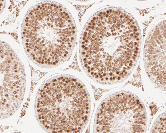 Immunohistochemical analysis of paraffin-embedded rat testis tissue with Rabbit anti-RanBP9 antibody (ET7110-95) at 1/200 dilution.<br />
<br />
The section was pre-treated using heat mediated antigen retrieval with sodium citrate buffer (pH 6.0) for 2 minutes. The tissues were blocked in 1% BSA for 20 minutes at room temperature, washed with ddH2O and PBS, and then probed with the primary antibody (ET7110-95) at 1/200 dilution for 1 hour at room temperature. The detection was performed using an HRP conjugated compact polymer system. DAB was used as the chromogen. Tissues were counterstained with hematoxylin and mounted with DPX.