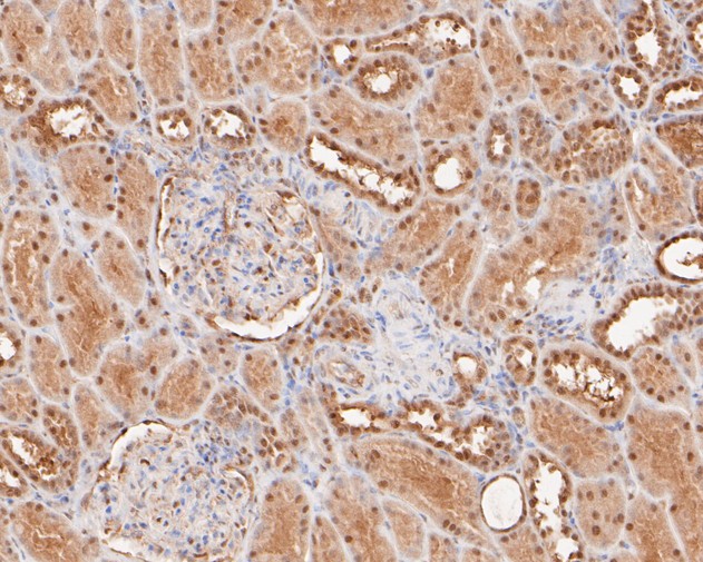 Immunohistochemical analysis of paraffin-embedded human kidney tissue with Rabbit anti-RanBP9 antibody (ET7110-95) at 1/200 dilution.<br />
<br />
The section was pre-treated using heat mediated antigen retrieval with sodium citrate buffer (pH 6.0) for 2 minutes. The tissues were blocked in 1% BSA for 20 minutes at room temperature, washed with ddH2O and PBS, and then probed with the primary antibody (ET7110-95) at 1/200 dilution for 1 hour at room temperature. The detection was performed using an HRP conjugated compact polymer system. DAB was used as the chromogen. Tissues were counterstained with hematoxylin and mounted with DPX.