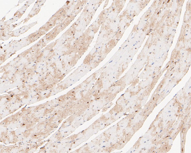 Immunohistochemical analysis of paraffin-embedded mouse heart tissue with Rabbit anti-RanBP9 antibody (ET7110-95) at 1/50 dilution.<br />
<br />
The section was pre-treated using heat mediated antigen retrieval with sodium citrate buffer (pH 6.0) for 2 minutes. The tissues were blocked in 1% BSA for 20 minutes at room temperature, washed with ddH2O and PBS, and then probed with the primary antibody (ET7110-95) at 1/50 dilution for 1 hour at room temperature. The detection was performed using an HRP conjugated compact polymer system. DAB was used as the chromogen. Tissues were counterstained with hematoxylin and mounted with DPX.