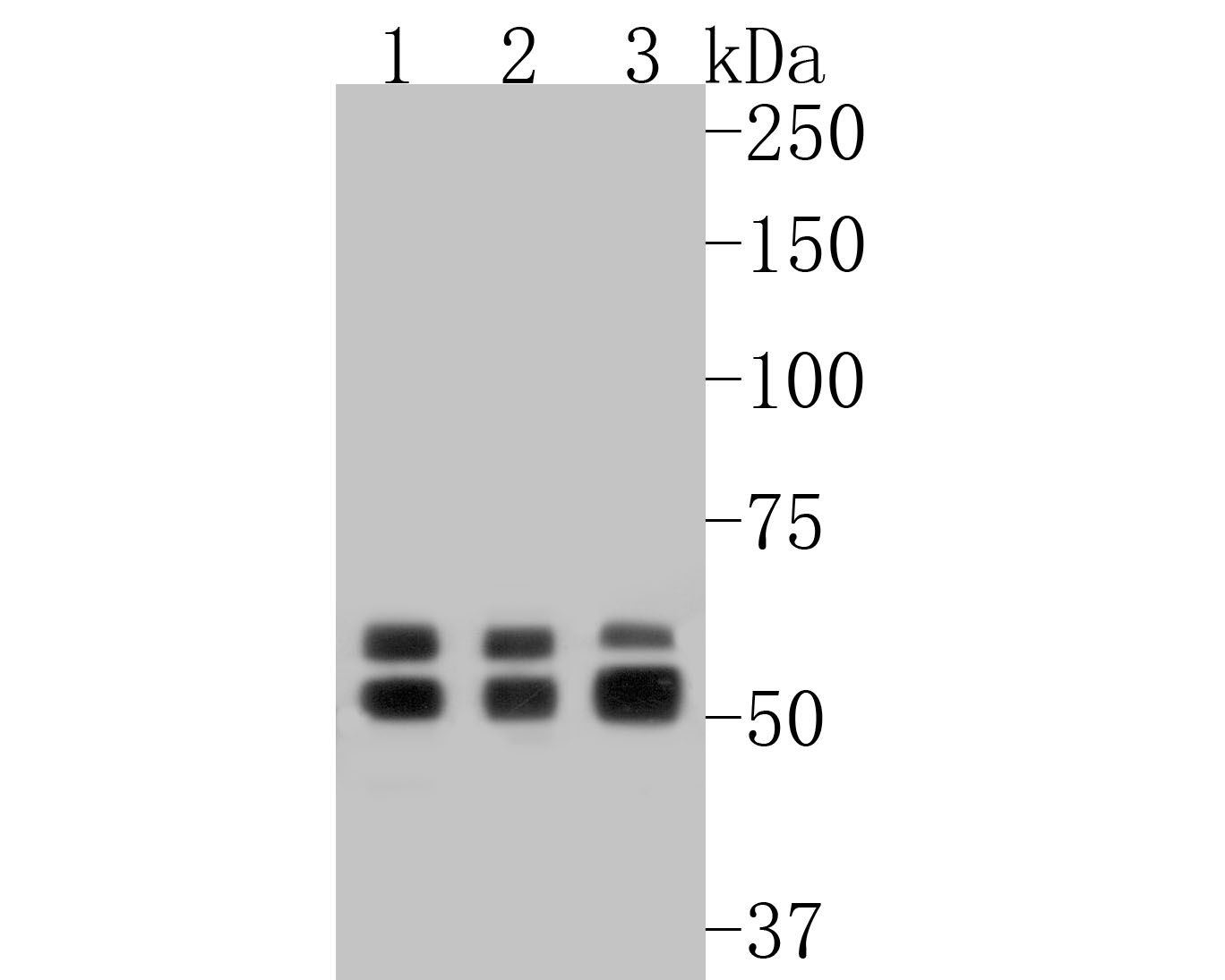 Western blot analysis of Glycerol Kinase on different lysates with Rabbit anti-Glycerol Kinase antibody (ET7110-96) at 1/500 dilution.<br />
<br />
Lane 1: Mouse liver tissue lysate<br />
Lane 2: Mouse kidney tissue lysate<br />
Lane 3: Rat kidney tissue lysate<br />
<br />
Lysates/proteins at 20 µg/Lane.<br />
<br />
Predicted band size: 61/57 kDa<br />
Observed band size: 61/57 kDa<br />
<br />
Exposure time: 2 minutes;<br />
<br />
8% SDS-PAGE gel.<br />
<br />
Proteins were transferred to a PVDF membrane and blocked with 5% NFDM/TBST for 1 hour at room temperature. The primary antibody (ET7110-96) at 1/500 dilution was used in 5% NFDM/TBST at room temperature for 2 hours. Goat Anti-Rabbit IgG - HRP Secondary Antibody (HA1001) at 1:5,000 dilution was used for 1 hour at room temperature.