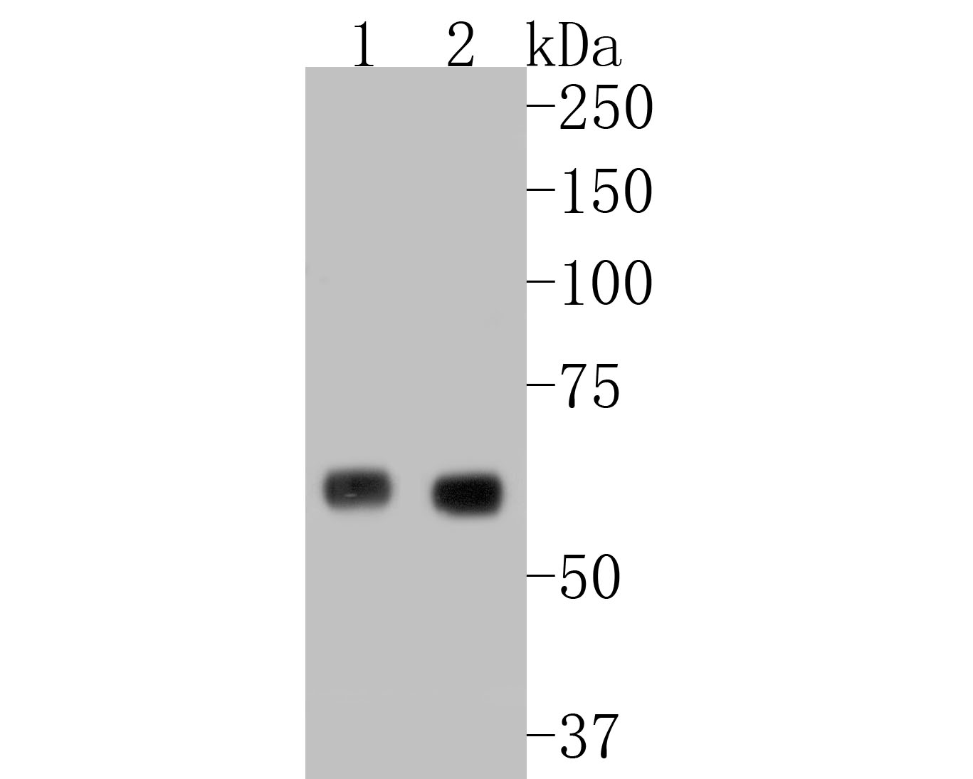 Western blot analysis of Glycerol Kinase on different lysates with Rabbit anti-Glycerol Kinase antibody (ET7110-96) at 1/500 dilution.<br />
<br />
Lane 1: Mouse bone marrow tissue lysate<br />
Lane 2: Rat testis tissue lysate<br />
<br />
Lysates/proteins at 20 µg/Lane.<br />
<br />
Predicted band size: 61/57 kDa<br />
Observed band size: 61 kDa<br />
<br />
Exposure time: 2 minutes;<br />
<br />
8% SDS-PAGE gel.<br />
<br />
Proteins were transferred to a PVDF membrane and blocked with 5% NFDM/TBST for 1 hour at room temperature. The primary antibody (ET7110-96) at 1/500 dilution was used in 5% NFDM/TBST at room temperature for 2 hours. Goat Anti-Rabbit IgG - HRP Secondary Antibody (HA1001) at 1:5,000 dilution was used for 1 hour at room temperature.