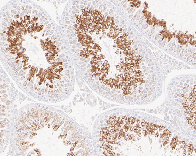 Immunohistochemical analysis of paraffin-embedded rat testis tissue with Rabbit anti-Glycerol Kinase antibody (ET7110-96) at 1/200 dilution.<br />
<br />
The section was pre-treated using heat mediated antigen retrieval with Tris-EDTA buffer(pH 8.0-8.4))for 20 minutes. The tissues were blocked in 1% BSA for 20 minutes at room temperature, washed with ddH2O and PBS, and then probed with the primary antibody (ET7110-96) at 1/200 dilution for 0.5 hour at room temperature. The detection was performed using an HRP conjugated compact polymer system. DAB was used as the chromogen. Tissues were counterstained with hematoxylin and mounted with DPX.