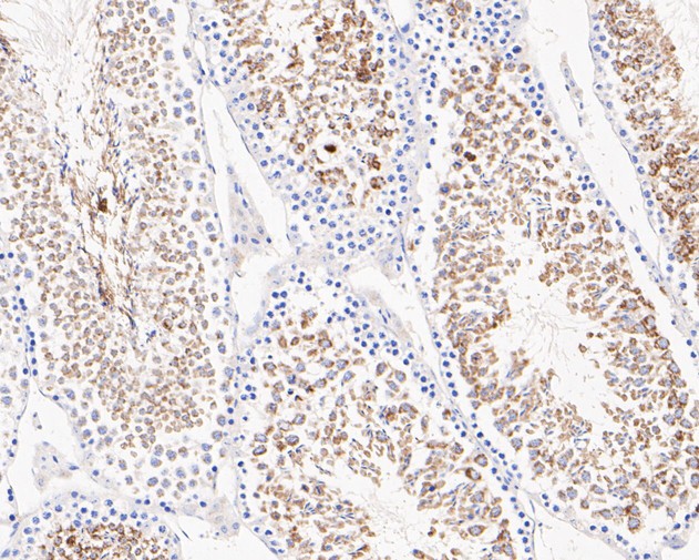 Immunohistochemical analysis of paraffin-embedded mouse testis tissue with Rabbit anti-Glycerol Kinase antibody (ET7110-96) at 1/200 dilution.<br />
<br />
The section was pre-treated using heat mediated antigen retrieval with Tris-EDTA buffer(pH 8.0-8.4))for 20 minutes. The tissues were blocked in 1% BSA for 20 minutes at room temperature, washed with ddH2O and PBS, and then probed with the primary antibody (ET7110-96) at 1/200 dilution for 0.5 hour at room temperature. The detection was performed using an HRP conjugated compact polymer system. DAB was used as the chromogen. Tissues were counterstained with hematoxylin and mounted with DPX.