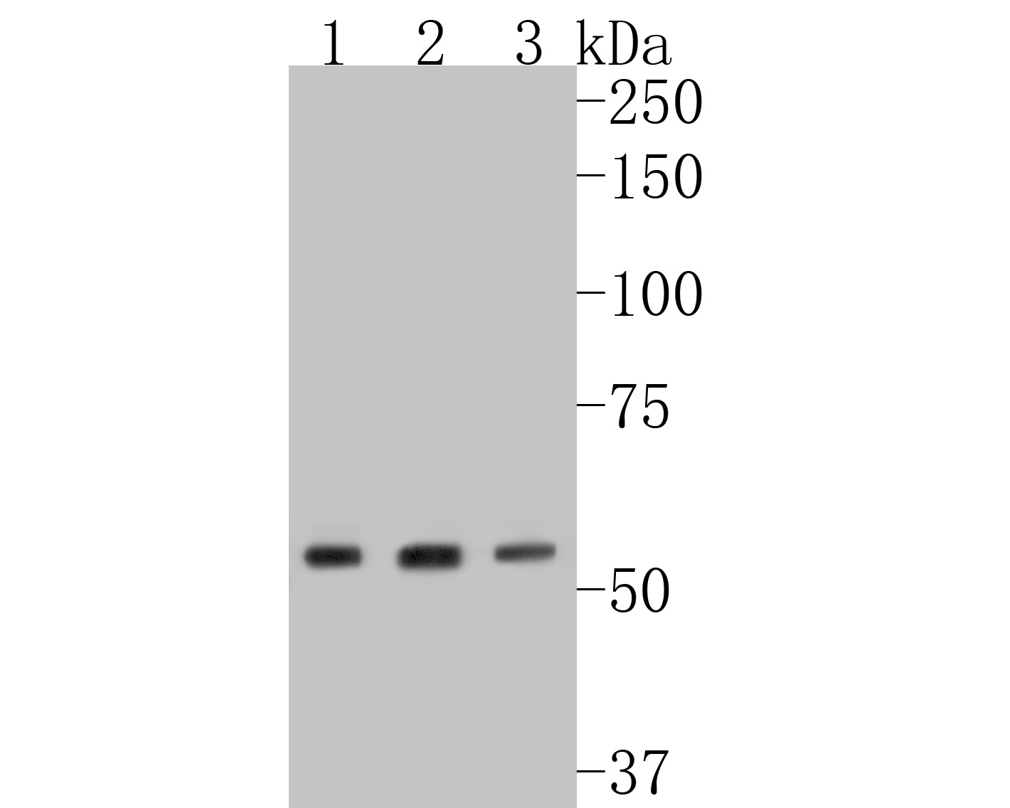 Western blot analysis of LMAN1 on different lysates. Proteins were transferred to a PVDF membrane and blocked with 5% BSA in PBS for 1 hour at room temperature. The primary antibody (ET7110-98, 1/500) was used in 5% BSA at room temperature for 2 hours. Goat Anti-Rabbit IgG - HRP Secondary Antibody (HA1001) at 1:5,000 dilution was used for 1 hour at room temperature.<br />
Positive control: <br />
Lane 1: NIH/3T3 cell lysate<br />
Lane 2: Human placenta tissue lysate<br />
Lane 3: HUVEC cell lysate