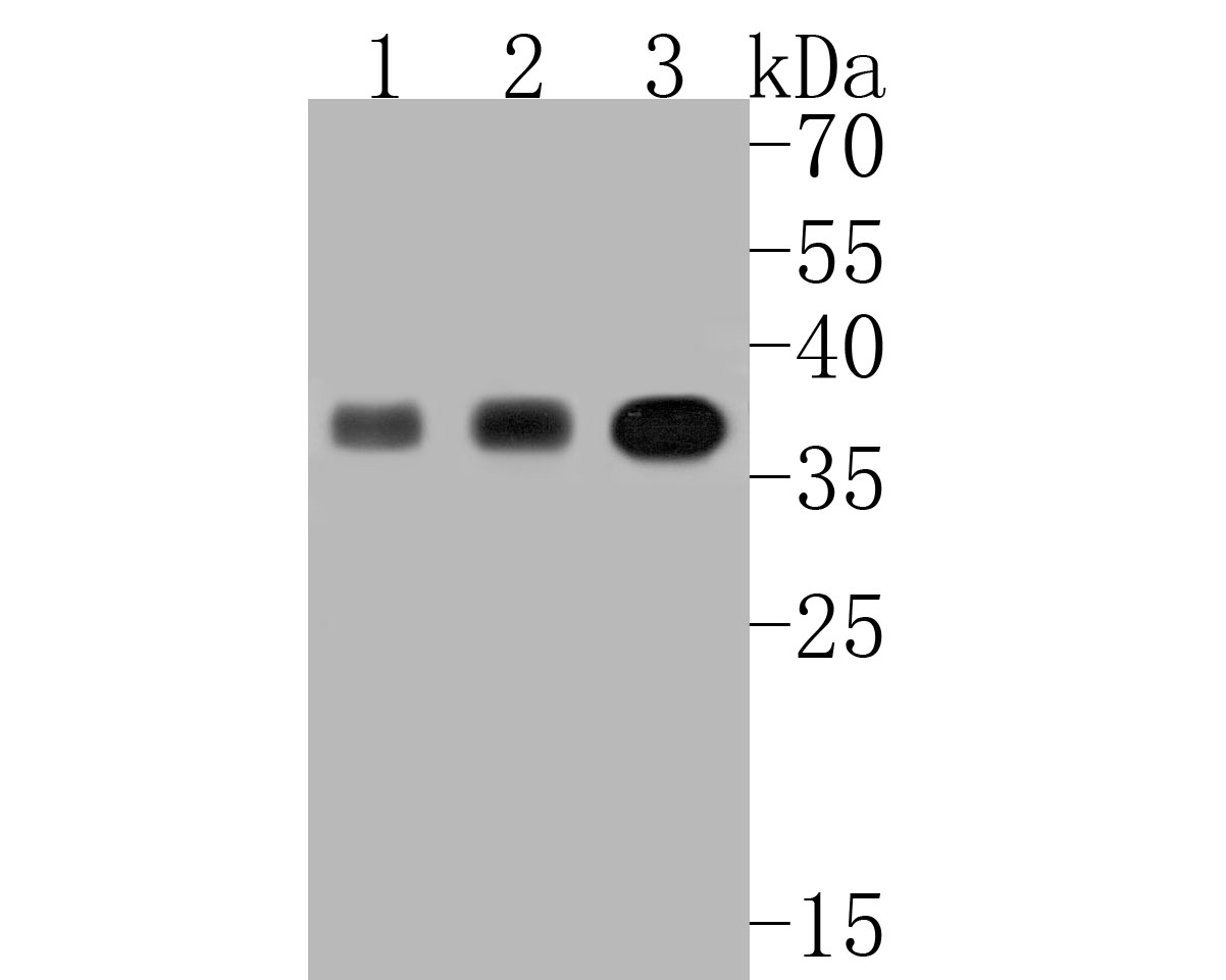 Western blot analysis of PDLIM1 on different lysates with Rabbit anti-PDLIM1 antibody (ET7110-99) at 1/500 dilution.<br />
<br />
Lane 1: Human placenta tissue lysate<br />
Lane 2: Mouse lung tissue lysate<br />
Lane 3: HepG2 cell lysate(10 µg/Lane)<br />
<br />
Lysates/proteins at 20 µg/Lane.<br />
<br />
Predicted band size: 36 kDa<br />
Observed band size: 36 kDa<br />
<br />
Exposure time: 2 minutes;<br />
<br />
12% SDS-PAGE gel.<br />
<br />
Proteins were transferred to a PVDF membrane and blocked with 5% NFDM/TBST for 1 hour at room temperature. The primary antibody (ET7110-99) at 1/500 dilution was used in 5% NFDM/TBST at room temperature for 2 hours. Goat Anti-Rabbit IgG - HRP Secondary Antibody (HA1001) at 1:5,000 dilution was used for 1 hour at room temperature.