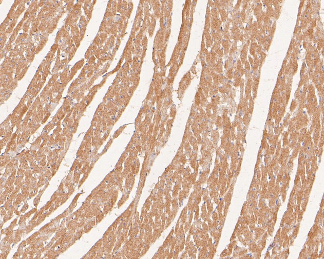 Immunohistochemical analysis of paraffin-embedded rat heart tissue with Rabbit anti-PDLIM1 antibody (ET7110-99) at 1/50 dilution.<br />
<br />
The section was pre-treated using heat mediated antigen retrieval with Tris-EDTA buffer (pH 6.0)) for 20 minutes. The tissues were blocked in 1% BSA for 20 minutes at room temperature, washed with ddH2O and PBS, and then probed with the primary antibody (ET7110-99) at 1/50 dilution for 0.5 hour at room temperature. The detection was performed using an HRP conjugated compact polymer system. DAB was used as the chromogen. Tissues were counterstained with hematoxylin and mounted with DPX.