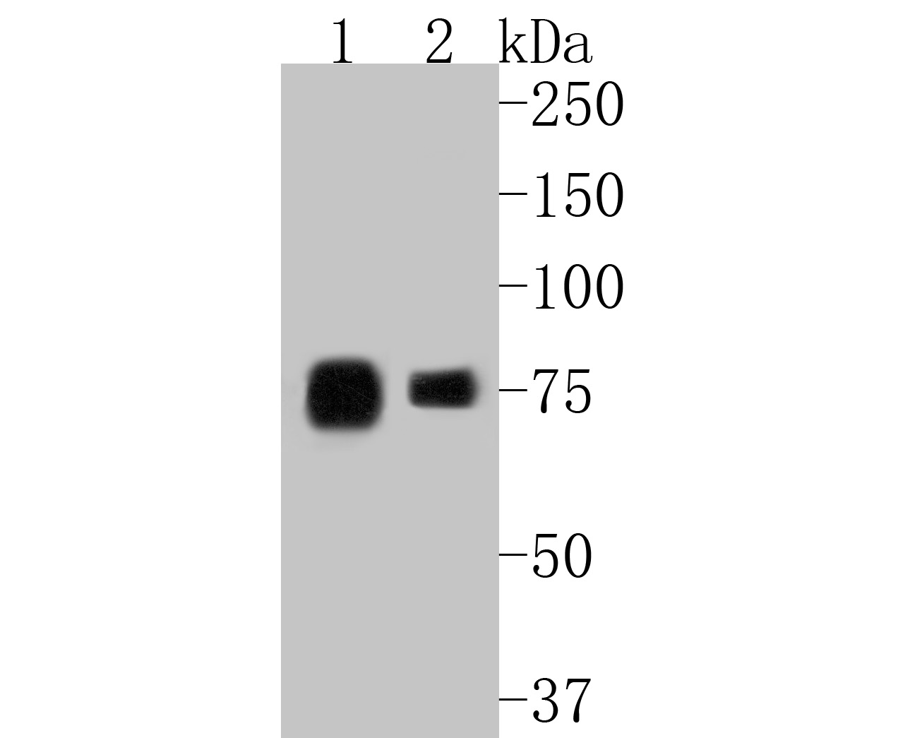Western blot analysis of LPP on different lysates. Proteins were transferred to a PVDF membrane and blocked with 5% BSA in PBS for 1 hour at room temperature. The primary antibody (ET7111-02, 1/500) was used in 5% BSA at room temperature for 2 hours. Goat Anti-Rabbit IgG - HRP Secondary Antibody (HA1001) at 1:5,000 dilution was used for 1 hour at room temperature.<br />
Positive control: <br />
Lane 1: Human skin tissue lysate<br />
Lane 2: Daudi cell lysate