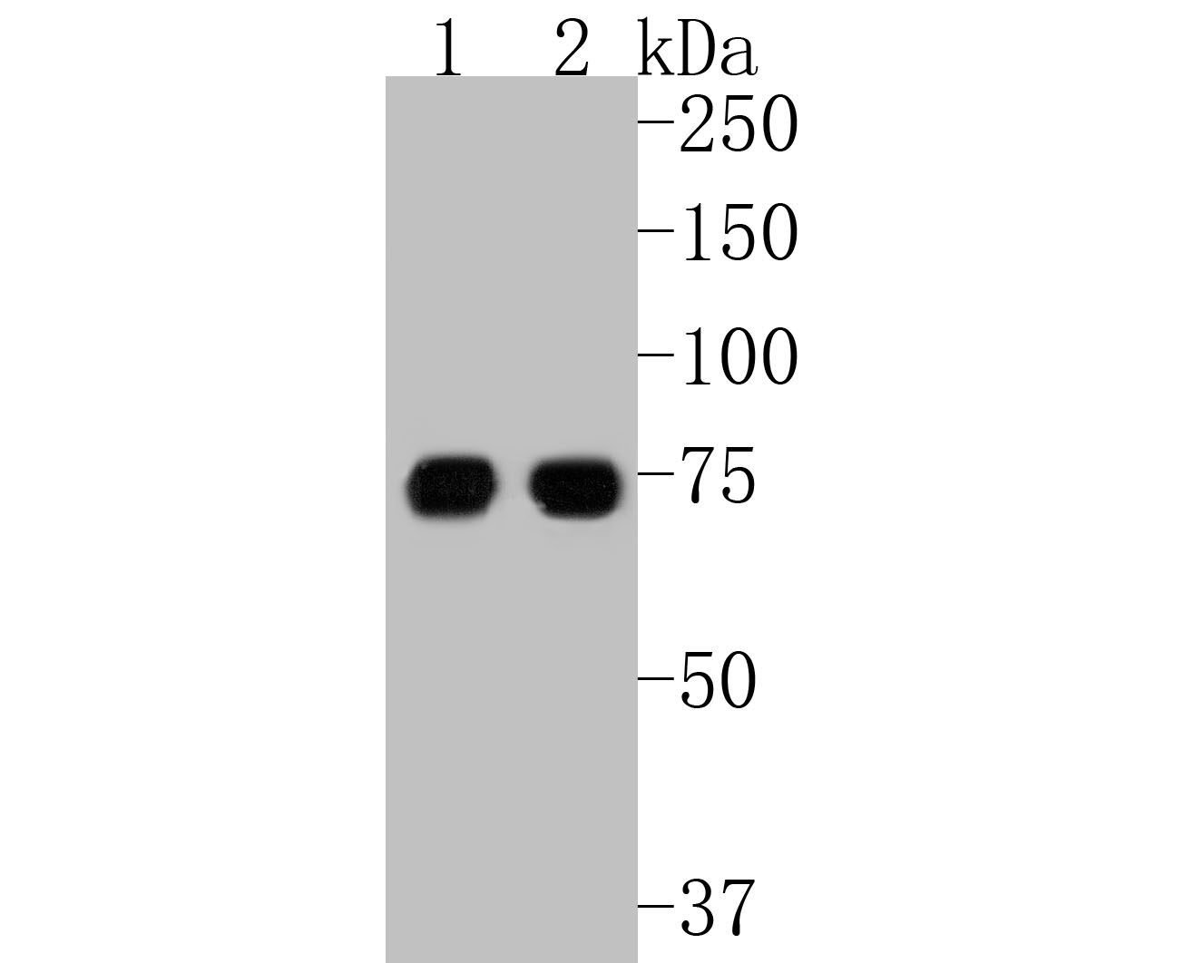 Western blot analysis of LPP on different lysates with Rabbit anti-LPP antibody (ET7111-02) at 1/500 dilution.<br />
<br />
Lane 1: Rat skin tissue lysate<br />
Lane 2: Mouse smooth muscle tissue lysate<br />
<br />
Lysates/proteins at 20 µg/Lane.<br />
<br />
Predicted band size: 66 kDa<br />
Observed band size: 75 kDa<br />
<br />
Exposure time: 2 minutes;<br />
<br />
8% SDS-PAGE gel.<br />
<br />
Proteins were transferred to a PVDF membrane and blocked with 5% NFDM/TBST for 1 hour at room temperature. The primary antibody (ET7111-02) at 1/500 dilution was used in 5% NFDM/TBST at room temperature for 2 hours. Goat Anti-Rabbit IgG - HRP Secondary Antibody (HA1001) at 1:5,000 dilution was used for 1 hour at room temperature.