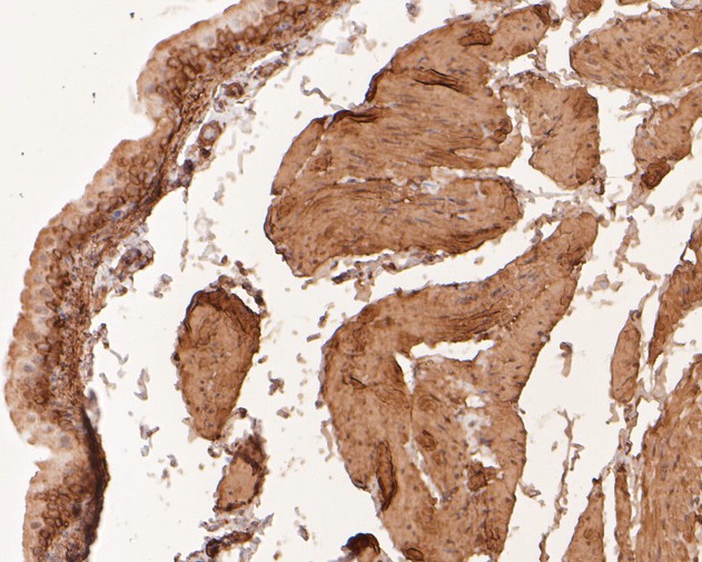 Immunohistochemical analysis of paraffin-embedded rat bladder tissue with Rabbit anti-LPP antibody (ET7111-02) at 1/400 dilution.<br />
<br />
The section was pre-treated using heat mediated antigen retrieval with sodium citrate buffer (pH 6.0) for 2 minutes. The tissues were blocked in 1% BSA for 20 minutes at room temperature, washed with ddH2O and PBS, and then probed with the primary antibody (ET7111-02) at 1/400 dilution for 1 hour at room temperature. The detection was performed using an HRP conjugated compact polymer system. DAB was used as the chromogen. Tissues were counterstained with hematoxylin and mounted with DPX.