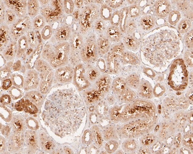 Immunohistochemical analysis of paraffin-embedded human kidney intestine tissue with Rabbit anti-LPP antibody (ET7111-02) at 1/50 dilution.<br />
<br />
The section was pre-treated using heat mediated antigen retrieval with sodium citrate buffer (pH 6.0) for 2 minutes. The tissues were blocked in 1% BSA for 20 minutes at room temperature, washed with ddH2O and PBS, and then probed with the primary antibody (ET7111-02) at 1/50 dilution for 1 hour at room temperature. The detection was performed using an HRP conjugated compact polymer system. DAB was used as the chromogen. Tissues were counterstained with hematoxylin and mounted with DPX.
