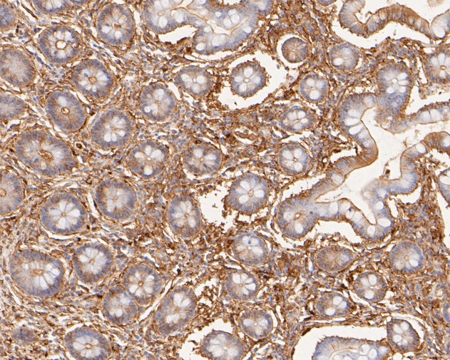 Immunohistochemical analysis of paraffin-embedded human small intestine tissue with Rabbit anti-LPP antibody (ET7111-02) at 1/50 dilution.<br />
<br />
The section was pre-treated using heat mediated antigen retrieval with sodium citrate buffer (pH 6.0) for 2 minutes. The tissues were blocked in 1% BSA for 20 minutes at room temperature, washed with ddH2O and PBS, and then probed with the primary antibody (ET7111-02) at 1/50 dilution for 1 hour at room temperature. The detection was performed using an HRP conjugated compact polymer system. DAB was used as the chromogen. Tissues were counterstained with hematoxylin and mounted with DPX.