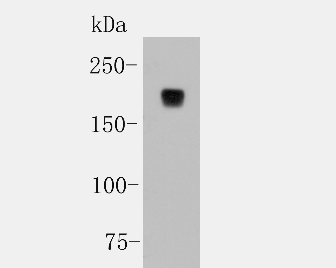 Western blot analysis of CD45 on Jurkat cell lysates with Rabbit anti-CD45 antibody (ET7111-03) at 1/1000 dilution.<br />
<br />
Lysates/proteins at 10 µg/Lane.<br />
<br />
Predicted band size: 147 kDa<br />
Observed band size: 200 kDa<br />
<br />
Exposure time: 2 minutes;<br />
<br />
8% SDS-PAGE gel.<br />
<br />
Proteins were transferred to a PVDF membrane and blocked with 5% NFDM/TBST for 1 hour at room temperature. The primary antibody (ET7111-03) at 1/1000 dilution was used in 5% NFDM/TBST at room temperature for 2 hours. Goat Anti-Rabbit IgG - HRP Secondary Antibody (HA1001) at 1:5,000 dilution was used for 1 hour at room temperature.