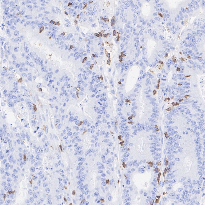 Immunohistochemical analysis of paraffin-embedded human tonsil tissue with Rabbit anti-CD45 antibody (ET7111-03) at 1/50 dilution.<br />
<br />
The section was pre-treated using heat mediated antigen retrieval with Tris-EDTA buffer (pH 6.0)) for 20 minutes. The tissues were blocked in 1% BSA for 20 minutes at room temperature, washed with ddH2O and PBS, and then probed with the primary antibody (ET7111-03) at 1/50 dilution for 0.5 hour at room temperature. The detection was performed using an HRP conjugated compact polymer system. DAB was used as the chromogen. Tissues were counterstained with hematoxylin and mounted with DPX.