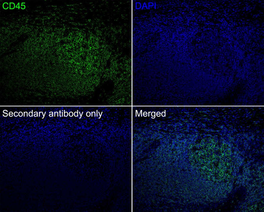 Immunofluorescence analysis of paraffin-embedded human tonsil tissue labeling CD45 with Rabbit anti-CD45 antibody (ET7111-03) at 1/500 dilution.<br />
<br />
The section was pre-treated using heat mediated antigen retrieval with Tris-EDTA buffer (pH 9.0) for 20 minutes. The tissues were blocked in 10% negative goat serum for 1 hour at room temperature, washed with PBS, and then probed with the primary antibody (ET7111-03, green) at 1/500 dilution overnight at 4 ℃, washed with PBS. Goat Anti-Rabbit IgG H&L (iFluor™ 488, HA1121) was used as the secondary antibody at 1/1,000 dilution. Nuclei were counterstained with DAPI (blue).