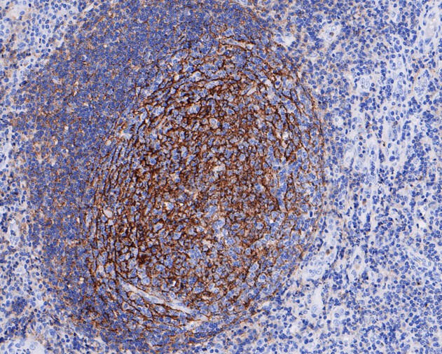 Immunohistochemical analysis of paraffin-embedded human tonsil tissue with Rabbit anti-CD35 antibody (ET7111-05) at 1/50 dilution.<br />
<br />
The section was pre-treated using heat mediated antigen retrieval with Tris-EDTA buffer (pH 6.0)) for 20 minutes. The tissues were blocked in 1% BSA for 20 minutes at room temperature, washed with ddH2O and PBS, and then probed with the primary antibody (ET7111-05) at 1/50 dilution for 0.5 hour at room temperature. The detection was performed using an HRP conjugated compact polymer system. DAB was used as the chromogen. Tissues were counterstained with hematoxylin and mounted with DPX.
