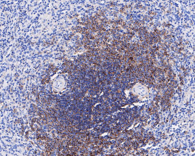 Immunohistochemical analysis of paraffin-embedded human spleen tissue with Rabbit anti-CD35 antibody (ET7111-05) at 1/50 dilution.<br />
<br />
The section was pre-treated using heat mediated antigen retrieval with sodium citrate buffer (pH 6.0) for 2 minutes. The tissues were blocked in 1% BSA for 20 minutes at room temperature, washed with ddH2O and PBS, and then probed with the primary antibody (ET7111-05) at 1/50 dilution for 1 hour at room temperature. The detection was performed using an HRP conjugated compact polymer system. DAB was used as the chromogen. Tissues were counterstained with hematoxylin and mounted with DPX.