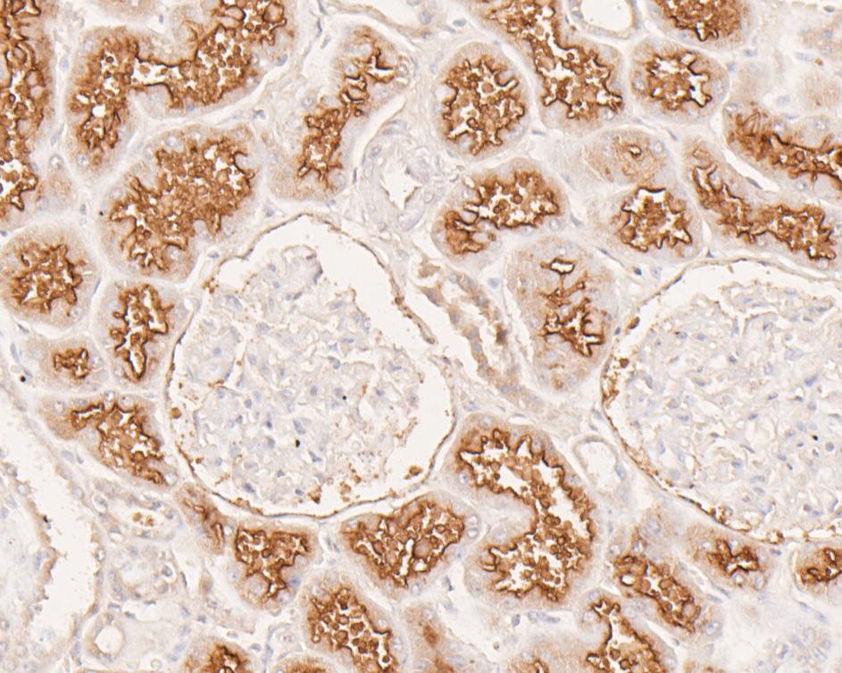 Immunohistochemical analysis of paraffin-embedded human Kidney tissue using rabbit anti-CD13 antibody.<br />
<br />
The section was pre-treated using heat mediated antigen retrieval with Tris-EDTA buffer (pH 8.0-8.4) for 20 minutes.The tissues were blocked in 5% BSA for 30 minutes at room temperature, washed with ddH2O and PBS, and then probed with the primary antibody (ER1803-45, 1/200) for 30 minutes at room temperature. Alpaca anti-rabbit IgG Fc, recombinant VHH (HRP) (HA1031, 1/200 dilution) was used for 30 min at room temperature. Tissues were counterstained with hematoxylin and mounted with DPX.