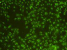 Immunofluorescent staining of MCF-7 cells using anti-ZFP-42 Mouse mAb (Cat. # M0731-7).