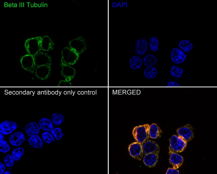 Immunocytochemistry analysis of HEK-293 cells labeling Beta III Tubulin with Mouse anti-Beta III Tubulin antibody (M0805-8) at 1/500 dilution.<br />
<br />
Cells were fixed in 4% paraformaldehyde for 20 minutes at room temperature, permeabilized with 0.1% Triton X-100 in PBS for 5 minutes at room temperature, then blocked with 1% BSA in 10% negative goat serum for 1 hour at room temperature. Cells were then incubated with Mouse anti-Beta III Tubulin antibody (M0805-8) at 1/500 dilution in 1% BSA in PBST overnight at 4 ℃. Goat Anti-Mouse IgG H&L (iFluor™ 488, HA1125) was used as the secondary antibody at 1/1,000 dilution. PBS instead of the primary antibody was used as the secondary antibody only control. Nuclear DNA was labelled in blue with DAPI.<br />
<br />
beta Tubulin (ET1602-4, red) was stained at 1/100 dilution overnight at +4℃. Goat Anti-Rabbit IgG H&L (iFluor™ 594, HA1122) were used as the secondary antibody at 1/1,000 dilution.