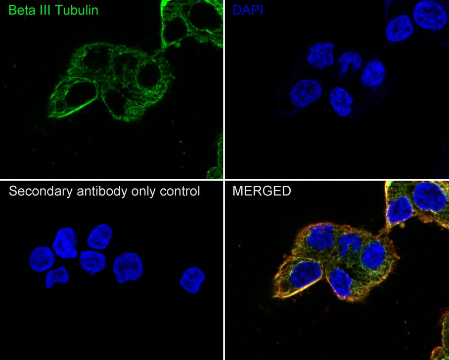 Immunocytochemistry analysis of SH-SY5Y cells labeling Beta III Tubulin with Mouse anti-Beta III Tubulin antibody (M0805-8) at 1/500 dilution.<br />
<br />
Cells were fixed in 4% paraformaldehyde for 20 minutes at room temperature, permeabilized with 0.1% Triton X-100 in PBS for 5 minutes at room temperature, then blocked with 1% BSA in 10% negative goat serum for 1 hour at room temperature. Cells were then incubated with Mouse anti-Beta III Tubulin antibody (M0805-8) at 1/500 dilution in 1% BSA in PBST overnight at 4 ℃. Goat Anti-Mouse IgG H&L (iFluor™ 488, HA1125) was used as the secondary antibody at 1/1,000 dilution. PBS instead of the primary antibody was used as the secondary antibody only control. Nuclear DNA was labelled in blue with DAPI.<br />
<br />
beta Tubulin (ET1602-4, red) was stained at 1/100 dilution overnight at +4℃. Goat Anti-Rabbit IgG H&L (iFluor™ 594, HA1122) were used as the secondary antibody at 1/1,000 dilution.