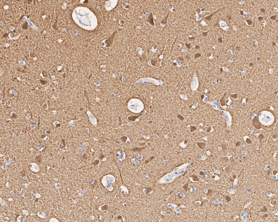 Immunohistochemical analysis of paraffin-embedded human brain tissue with Mouse anti-Beta III Tubulin antibody (M0805-8) at 1/2,000 dilution.<br />
<br />
The section was pre-treated using heat mediated antigen retrieval with Tris-EDTA buffer (pH 9.0) for 20 minutes. The tissues were blocked in 1% BSA for 20 minutes at room temperature, washed with ddH2O and PBS, and then probed with the primary antibody (M0805-8) at 1/2,000 dilution for 1 hour at room temperature. The detection was performed using an HRP conjugated compact polymer system. DAB was used as the chromogen. Tissues were counterstained with hematoxylin and mounted with DPX.