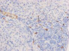 Alkaline Phosphatase Mouse monoclonal Antibody