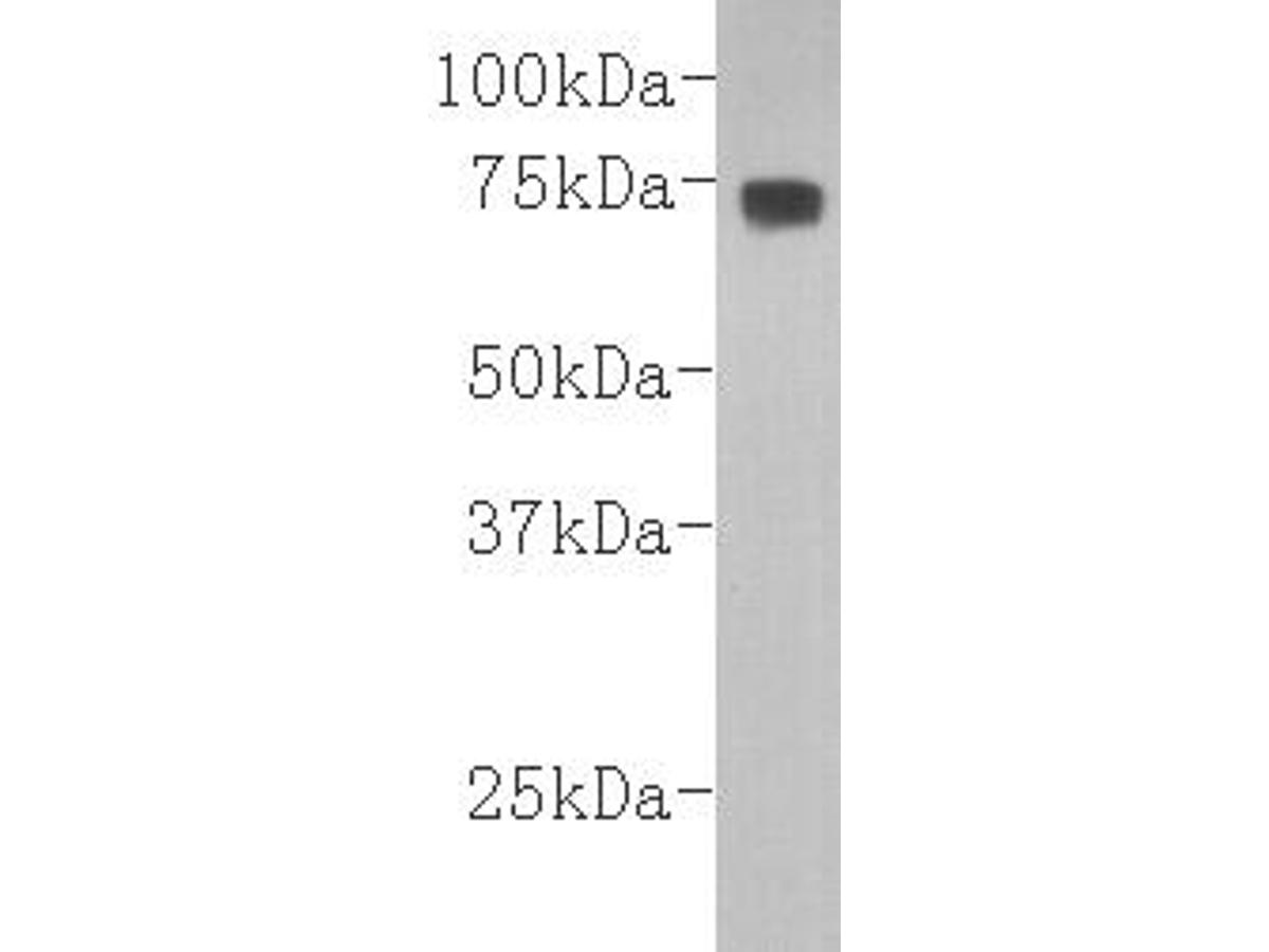 Western blot analysis on human plasma lysates using anti-C3(β-chain) Mouse mAb (Cat. # M0809-14).